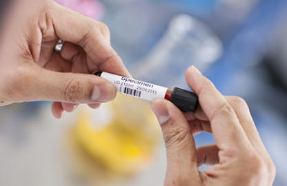 Blood sample label